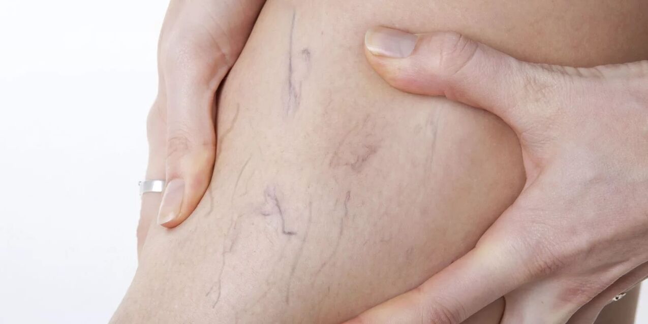 barize krema erabili aurretik